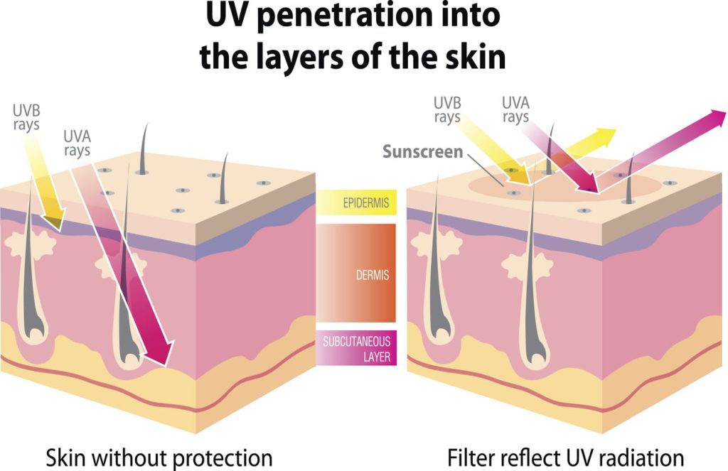 uv-rays